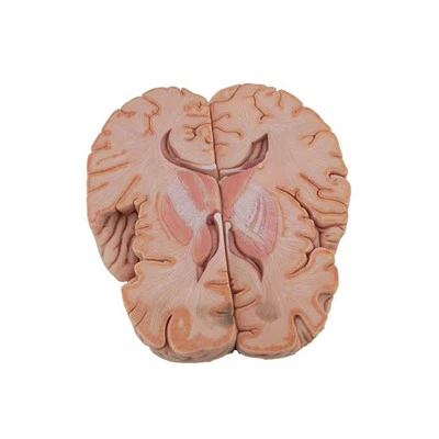 Model poprečnog presjeka mozga